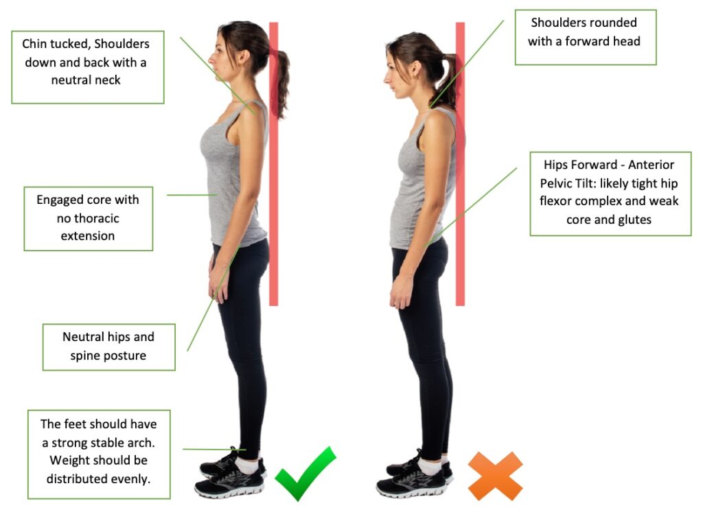 posture good vs bad