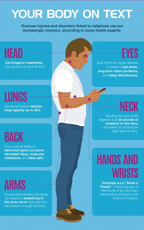 Can Bad Posture Cause Chest Pain